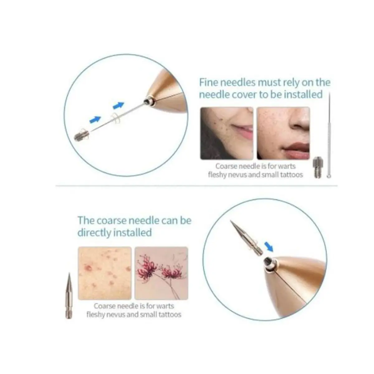 Cauterizador quita verrugas dorado con dos tipos de agujas: finas con cubierta y gruesas directas para verrugas y tatuajes pequeños.
