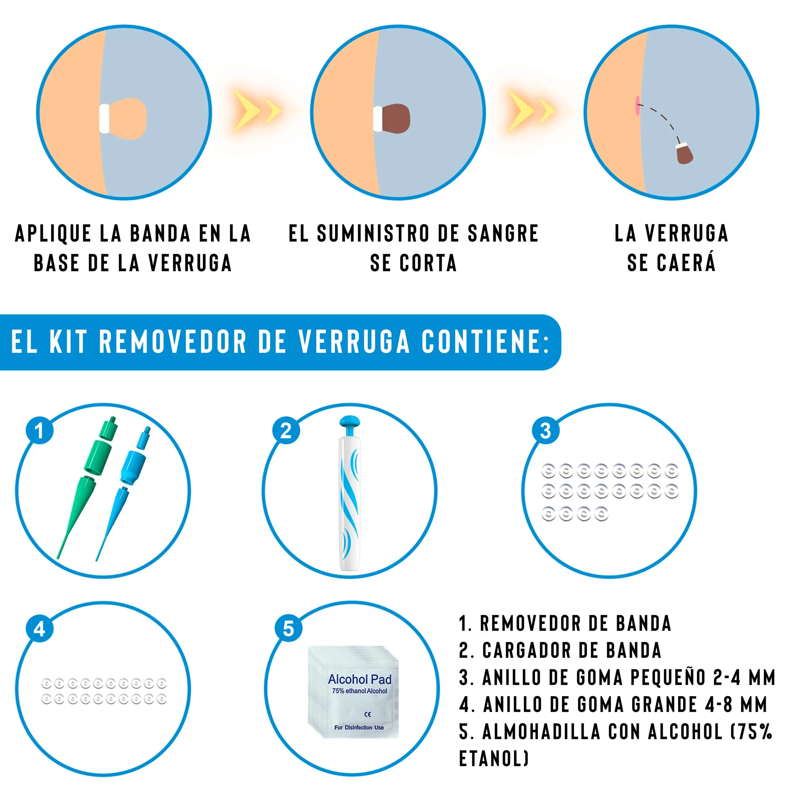 Kit eliminador de verrugas con banda de silicona, aplicador, cargador y almohadillas de alcohol.