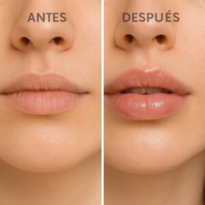 Voluminizador Kiss Beauty: labios antes y después, muestra el efecto de volumen e hidratación instantáneo.