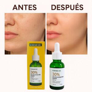 Sérum Kormesic 30% AHA antes y después, piel renovada e iluminada. Presentación de 30ml y 50ml.