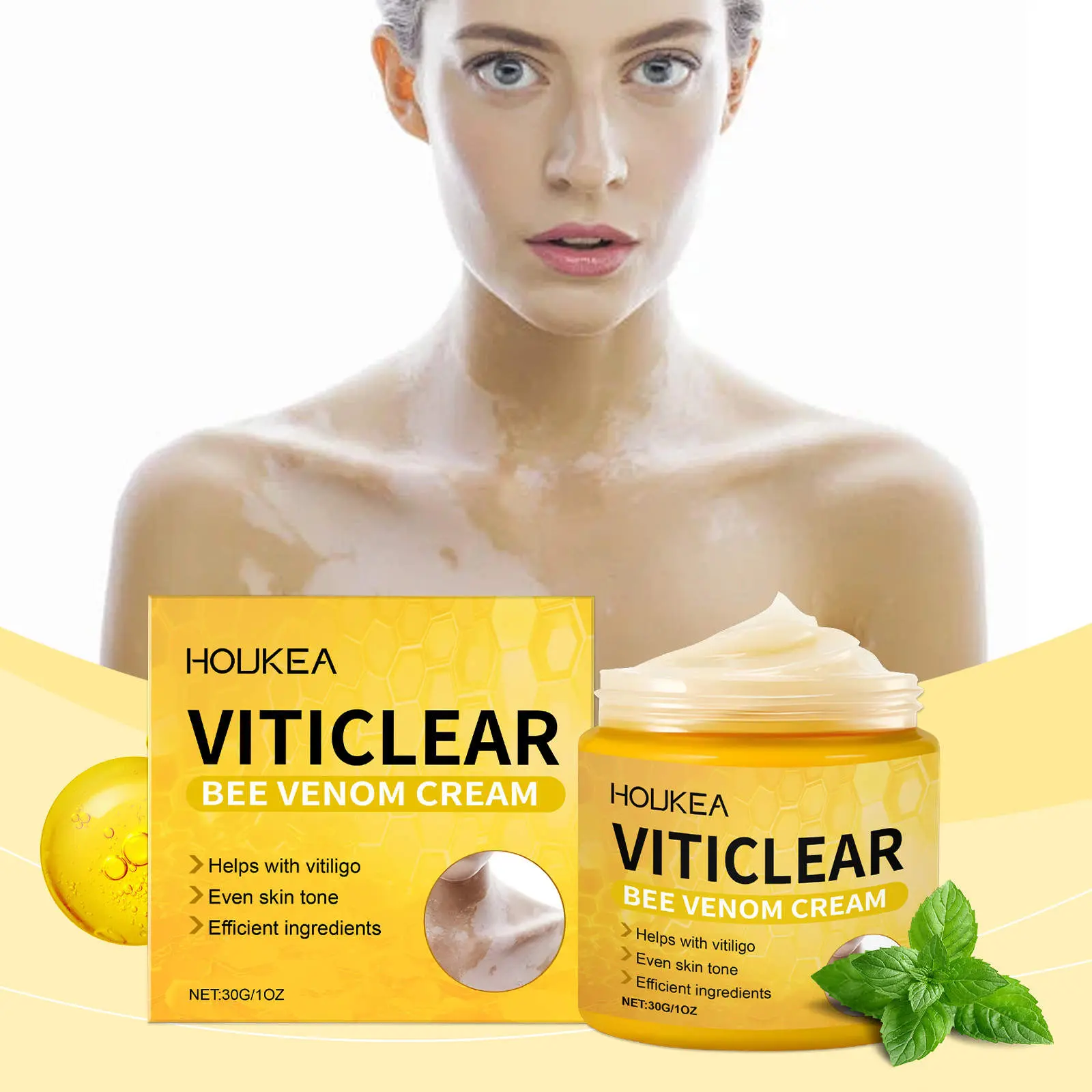 Crema Viticlear con veneno de abeja para vitiligo, que unifica el tono de piel. Incluye caja y tarro de 30g/1oz.
