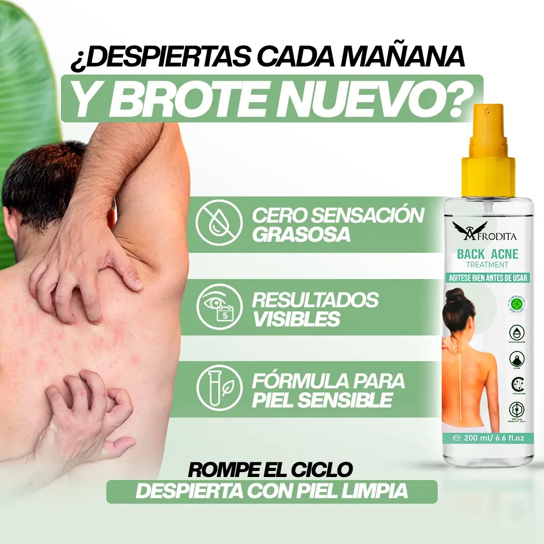 Spray corporal anti-acné para espalda y hombros, elimina brotes, piel sensible, 200 ml.