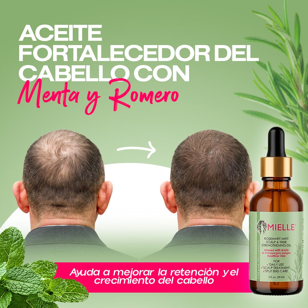 Serum Mielle Rosemary Mint para crecimiento y fortalecimiento capilar, mostrando mejora capilar de un hombre.