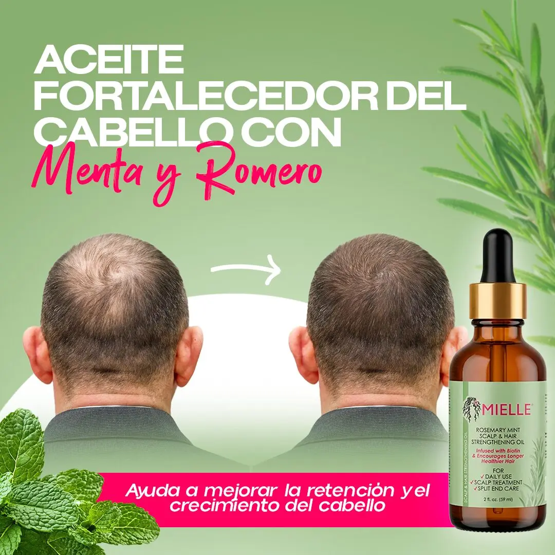 Serum Mielle Rosemary Mint para crecimiento y fortalecimiento capilar, mostrando mejora capilar de un hombre.