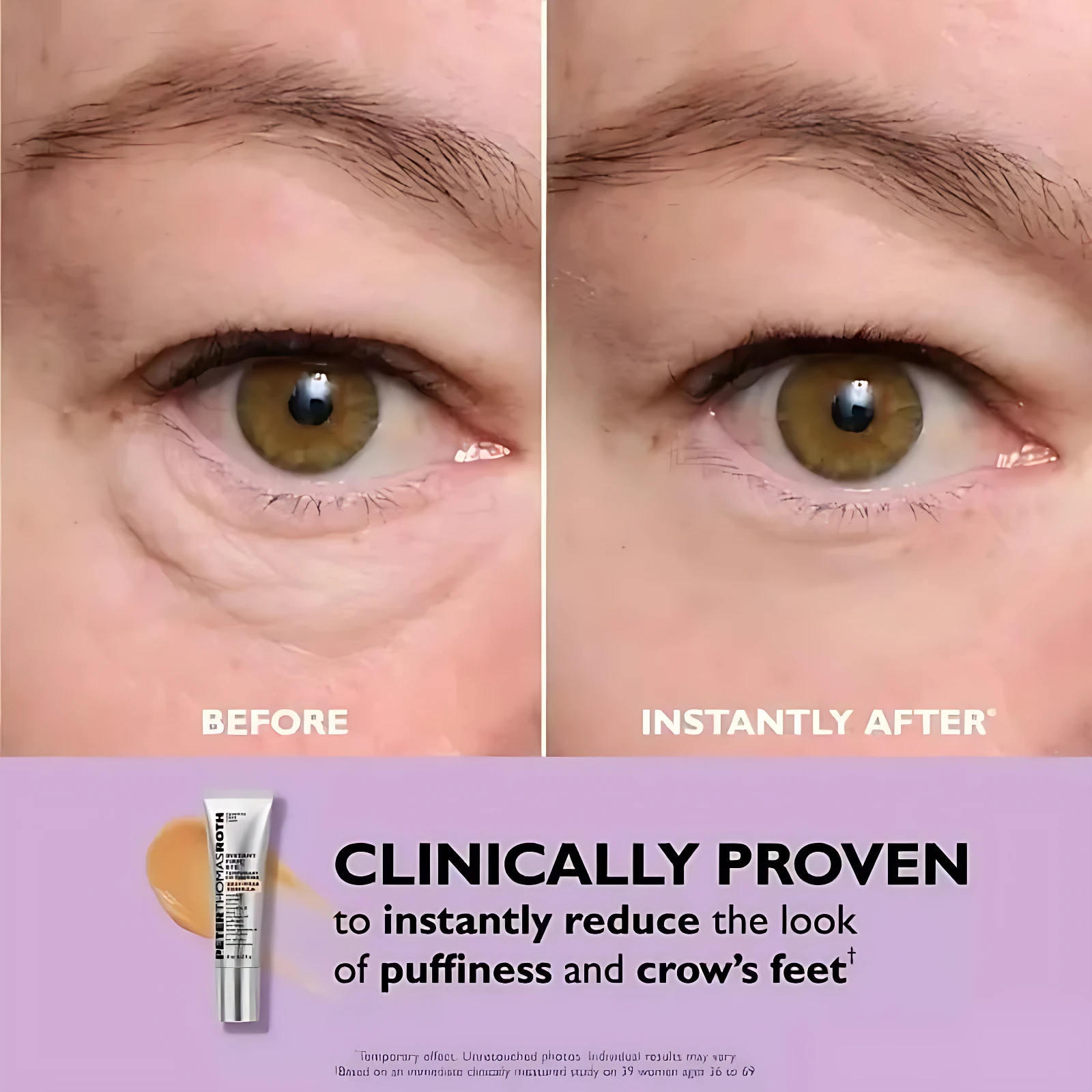 Crema para ojos antes y después, reduce bolsas y arrugas, con aplicador.