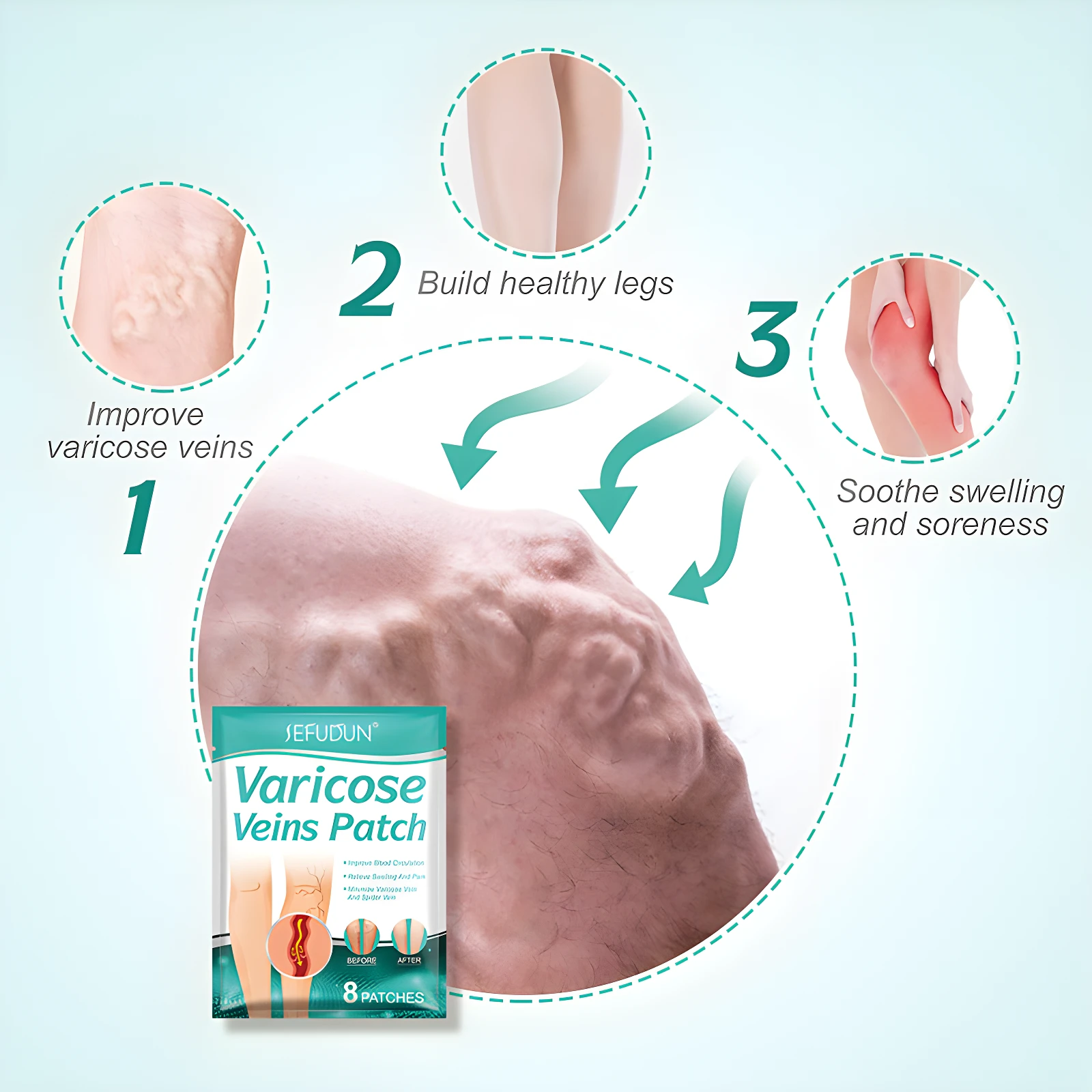 Parches para varices SEFUDUN, muestra mejora, piernas sanas y alivio de dolor. Incluye 8 parches.